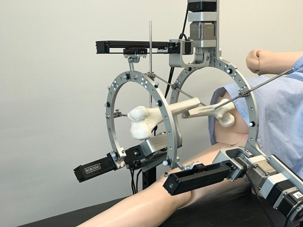 Robossis is the first surgical robotic system designed to realign broken femurs. This is a detail shot of a simulated broken femur held within the robot's metal halo.